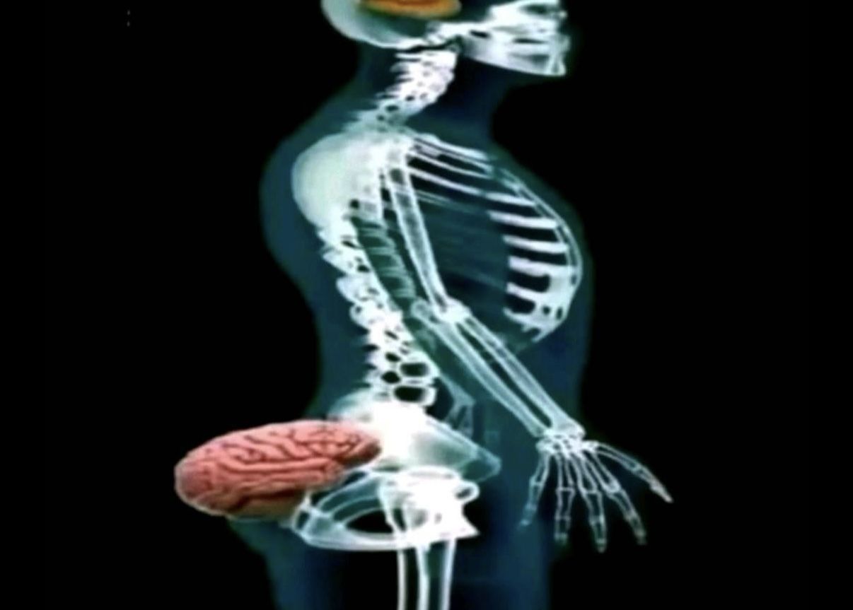 brain in butt